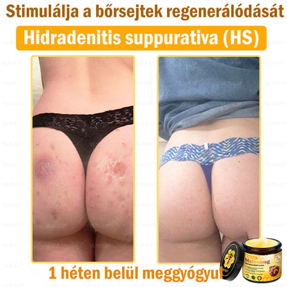 🎀🎀VLSVLS® 𝐌É𝐇𝐌É𝐑𝐄𝐆 Á𝐓𝐅𝐎𝐆Ó 𝐊𝐑É𝐌🥇𝐀 𝐛ö𝐫𝐩𝐫𝐨𝐛𝐥é𝐦á𝐤 𝐤𝐞𝐳𝐞𝐥é𝐬𝐞 𝐦𝐚𝐠á𝐛𝐚𝐧 𝐟𝐨𝐠𝐥𝐚𝐥𝐣𝐚: é𝐥𝐞𝐭𝐤𝐨𝐫𝐢 𝐟𝐨𝐥𝐭𝐨𝐤, 𝐡𝐞𝐠𝐞𝐤, 𝐬𝐳𝐞𝐦ö𝐥𝐜𝐬ö𝐤, 𝐛ö𝐫𝐧ö𝐯𝐞𝐝é𝐤𝐞𝐤, 𝐭á𝐥𝐲𝐨𝐠𝐨𝐤, 𝐩𝐚𝐭𝐭𝐚𝐧á𝐬𝐨𝐤, 𝐞𝐤𝐜é𝐦𝐚, 𝐩𝐬𝐨𝐫𝐢𝐚𝐬𝐢𝐬, 𝐚𝐜𝐧𝐞 𝐢𝐧𝐯𝐞𝐫𝐬𝐚, 𝐫á𝐧𝐜𝐨𝐤, 𝐛ö𝐫ö𝐫𝐞𝐠𝐞𝐝é𝐬 é𝐬 𝐞𝐠𝐲é𝐛 𝐩𝐫𝐨𝐛𝐥é𝐦á𝐤🔥
