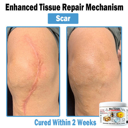 TO𝐃𝐀HOF®🥥🍈 𝑩𝒆𝐞 𝑽𝐞𝒏𝒐𝒎 𝑴𝒖𝒍𝒕𝒊-𝑺𝒚𝒎𝒑𝒕𝒐𝒎 𝑺𝒌𝒊𝒏 𝑻𝒓𝒆𝒂𝒕𝒎𝐞𝒏𝒕 𝑪𝒓𝐞𝒂𝒎