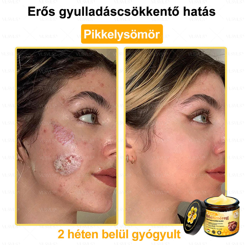 🎀🎀VLSVLS® 𝐌É𝐇𝐌É𝐑𝐄𝐆 Á𝐓𝐅𝐎𝐆Ó 𝐊𝐑É𝐌🥇𝐀 𝐛ö𝐫𝐩𝐫𝐨𝐛𝐥é𝐦á𝐤 𝐤𝐞𝐳𝐞𝐥é𝐬𝐞 𝐦𝐚𝐠á𝐛𝐚𝐧 𝐟𝐨𝐠𝐥𝐚𝐥𝐣𝐚: é𝐥𝐞𝐭𝐤𝐨𝐫𝐢 𝐟𝐨𝐥𝐭𝐨𝐤, 𝐡𝐞𝐠𝐞𝐤, 𝐬𝐳𝐞𝐦ö𝐥𝐜𝐬ö𝐤, 𝐛ö𝐫𝐧ö𝐯𝐞𝐝é𝐤𝐞𝐤, 𝐭á𝐥𝐲𝐨𝐠𝐨𝐤, 𝐩𝐚𝐭𝐭𝐚𝐧á𝐬𝐨𝐤, 𝐞𝐤𝐜é𝐦𝐚, 𝐩𝐬𝐨𝐫𝐢𝐚𝐬𝐢𝐬, 𝐚𝐜𝐧𝐞 𝐢𝐧𝐯𝐞𝐫𝐬𝐚, 𝐫á𝐧𝐜𝐨𝐤, 𝐛ö𝐫ö𝐫𝐞𝐠𝐞𝐝é𝐬 é𝐬 𝐞𝐠𝐲é𝐛 𝐩𝐫𝐨𝐛𝐥é𝐦á𝐤🔥