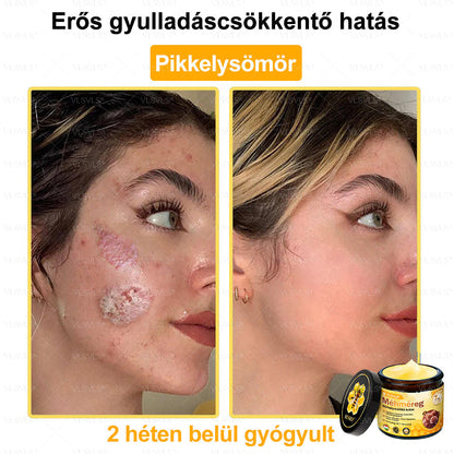🎀🎀VLSVLS® 𝐌É𝐇𝐌É𝐑𝐄𝐆 Á𝐓𝐅𝐎𝐆Ó 𝐊𝐑É𝐌🥇𝐀 𝐛ö𝐫𝐩𝐫𝐨𝐛𝐥é𝐦á𝐤 𝐤𝐞𝐳𝐞𝐥é𝐬𝐞 𝐦𝐚𝐠á𝐛𝐚𝐧 𝐟𝐨𝐠𝐥𝐚𝐥𝐣𝐚: é𝐥𝐞𝐭𝐤𝐨𝐫𝐢 𝐟𝐨𝐥𝐭𝐨𝐤, 𝐡𝐞𝐠𝐞𝐤, 𝐬𝐳𝐞𝐦ö𝐥𝐜𝐬ö𝐤, 𝐛ö𝐫𝐧ö𝐯𝐞𝐝é𝐤𝐞𝐤, 𝐭á𝐥𝐲𝐨𝐠𝐨𝐤, 𝐩𝐚𝐭𝐭𝐚𝐧á𝐬𝐨𝐤, 𝐞𝐤𝐜é𝐦𝐚, 𝐩𝐬𝐨𝐫𝐢𝐚𝐬𝐢𝐬, 𝐚𝐜𝐧𝐞 𝐢𝐧𝐯𝐞𝐫𝐬𝐚, 𝐫á𝐧𝐜𝐨𝐤, 𝐛ö𝐫ö𝐫𝐞𝐠𝐞𝐝é𝐬 é𝐬 𝐞𝐠𝐲é𝐛 𝐩𝐫𝐨𝐛𝐥é𝐦á𝐤🔥