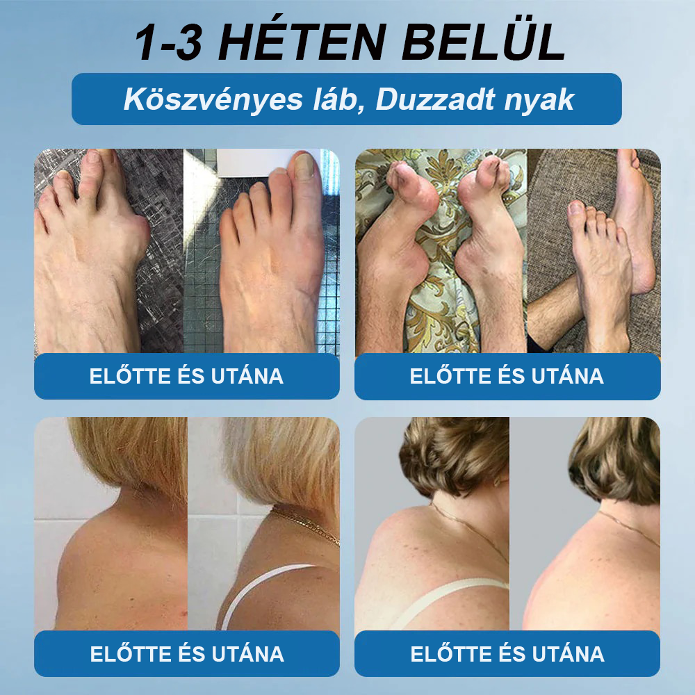 【További 30% kedvezmény】𝖯𝗂𝖼𝗱𝗼® BPC-157 Ízületi Gyógyító Krém