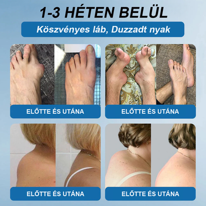 【További 30% kedvezmény】𝖯𝗂𝖼𝗱𝗼® BPC-157 Ízületi Gyógyító Krém