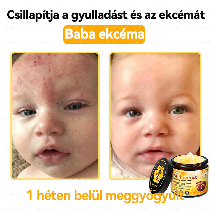 🎀🎀VLSVLS® 𝐌É𝐇𝐌É𝐑𝐄𝐆 Á𝐓𝐅𝐎𝐆Ó 𝐊𝐑É𝐌🥇𝐀 𝐛ö𝐫𝐩𝐫𝐨𝐛𝐥é𝐦á𝐤 𝐤𝐞𝐳𝐞𝐥é𝐬𝐞 𝐦𝐚𝐠á𝐛𝐚𝐧 𝐟𝐨𝐠𝐥𝐚𝐥𝐣𝐚: é𝐥𝐞𝐭𝐤𝐨𝐫𝐢 𝐟𝐨𝐥𝐭𝐨𝐤, 𝐡𝐞𝐠𝐞𝐤, 𝐬𝐳𝐞𝐦ö𝐥𝐜𝐬ö𝐤, 𝐛ö𝐫𝐧ö𝐯𝐞𝐝é𝐤𝐞𝐤, 𝐭á𝐥𝐲𝐨𝐠𝐨𝐤, 𝐩𝐚𝐭𝐭𝐚𝐧á𝐬𝐨𝐤, 𝐞𝐤𝐜é𝐦𝐚, 𝐩𝐬𝐨𝐫𝐢𝐚𝐬𝐢𝐬, 𝐚𝐜𝐧𝐞 𝐢𝐧𝐯𝐞𝐫𝐬𝐚, 𝐫á𝐧𝐜𝐨𝐤, 𝐛ö𝐫ö𝐫𝐞𝐠𝐞𝐝é𝐬 é𝐬 𝐞𝐠𝐲é𝐛 𝐩𝐫𝐨𝐛𝐥é𝐦á𝐤🔥