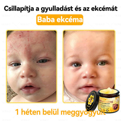 🎀🎀VLSVLS® 𝐌É𝐇𝐌É𝐑𝐄𝐆 Á𝐓𝐅𝐎𝐆Ó 𝐊𝐑É𝐌🥇𝐀 𝐛ö𝐫𝐩𝐫𝐨𝐛𝐥é𝐦á𝐤 𝐤𝐞𝐳𝐞𝐥é𝐬𝐞 𝐦𝐚𝐠á𝐛𝐚𝐧 𝐟𝐨𝐠𝐥𝐚𝐥𝐣𝐚: é𝐥𝐞𝐭𝐤𝐨𝐫𝐢 𝐟𝐨𝐥𝐭𝐨𝐤, 𝐡𝐞𝐠𝐞𝐤, 𝐬𝐳𝐞𝐦ö𝐥𝐜𝐬ö𝐤, 𝐛ö𝐫𝐧ö𝐯𝐞𝐝é𝐤𝐞𝐤, 𝐭á𝐥𝐲𝐨𝐠𝐨𝐤, 𝐩𝐚𝐭𝐭𝐚𝐧á𝐬𝐨𝐤, 𝐞𝐤𝐜é𝐦𝐚, 𝐩𝐬𝐨𝐫𝐢𝐚𝐬𝐢𝐬, 𝐚𝐜𝐧𝐞 𝐢𝐧𝐯𝐞𝐫𝐬𝐚, 𝐫á𝐧𝐜𝐨𝐤, 𝐛ö𝐫ö𝐫𝐞𝐠𝐞𝐝é𝐬 é𝐬 𝐞𝐠𝐲é𝐛 𝐩𝐫𝐨𝐛𝐥é𝐦á𝐤🔥