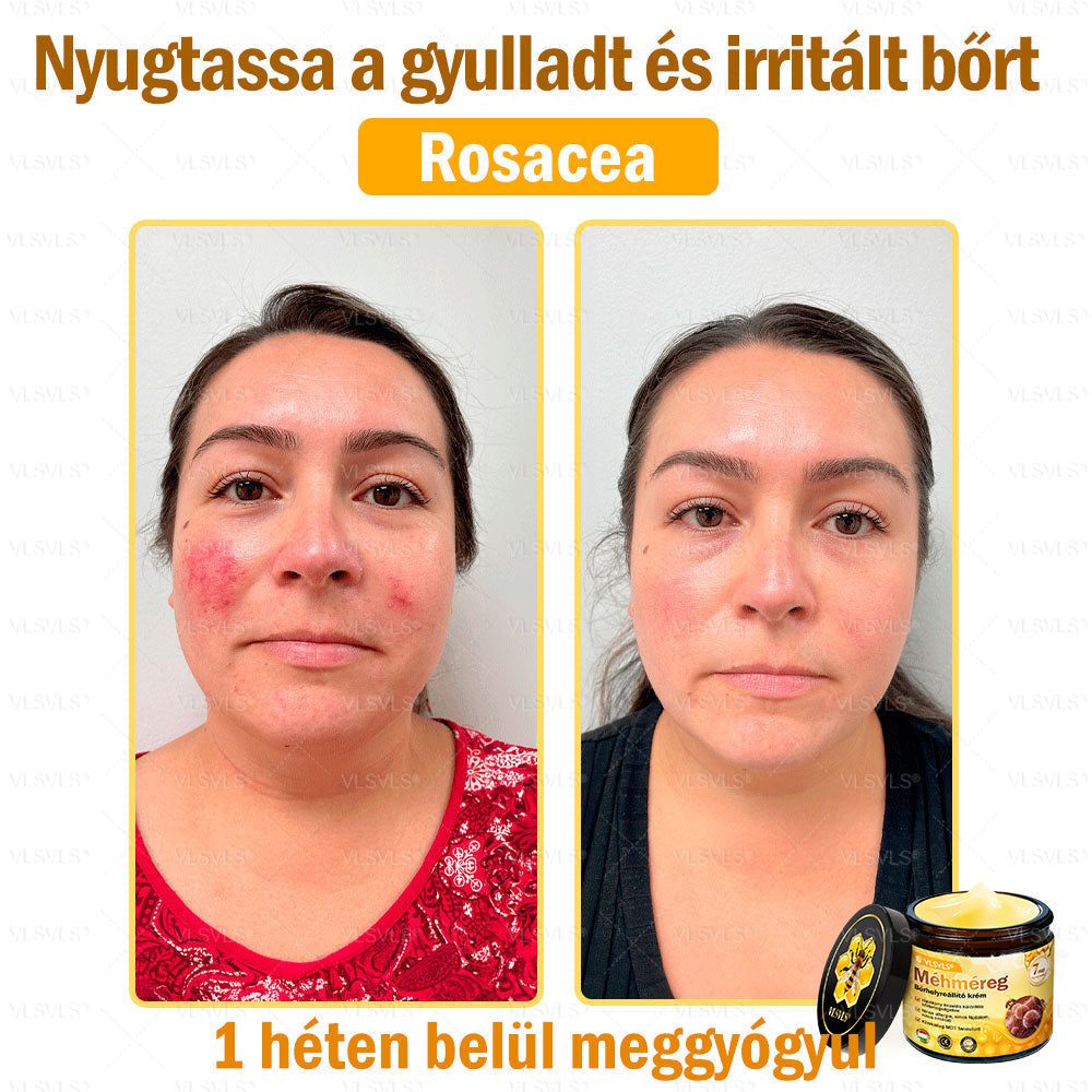 🎀🎀VLSVLS® 𝐌É𝐇𝐌É𝐑𝐄𝐆 Á𝐓𝐅𝐎𝐆Ó 𝐊𝐑É𝐌🥇𝐀 𝐛ö𝐫𝐩𝐫𝐨𝐛𝐥é𝐦á𝐤 𝐤𝐞𝐳𝐞𝐥é𝐬𝐞 𝐦𝐚𝐠á𝐛𝐚𝐧 𝐟𝐨𝐠𝐥𝐚𝐥𝐣𝐚: é𝐥𝐞𝐭𝐤𝐨𝐫𝐢 𝐟𝐨𝐥𝐭𝐨𝐤, 𝐡𝐞𝐠𝐞𝐤, 𝐬𝐳𝐞𝐦ö𝐥𝐜𝐬ö𝐤, 𝐛ö𝐫𝐧ö𝐯𝐞𝐝é𝐤𝐞𝐤, 𝐭á𝐥𝐲𝐨𝐠𝐨𝐤, 𝐩𝐚𝐭𝐭𝐚𝐧á𝐬𝐨𝐤, 𝐞𝐤𝐜é𝐦𝐚, 𝐩𝐬𝐨𝐫𝐢𝐚𝐬𝐢𝐬, 𝐚𝐜𝐧𝐞 𝐢𝐧𝐯𝐞𝐫𝐬𝐚, 𝐫á𝐧𝐜𝐨𝐤, 𝐛ö𝐫ö𝐫𝐞𝐠𝐞𝐝é𝐬 é𝐬 𝐞𝐠𝐲é𝐛 𝐩𝐫𝐨𝐛𝐥é𝐦á𝐤🔥