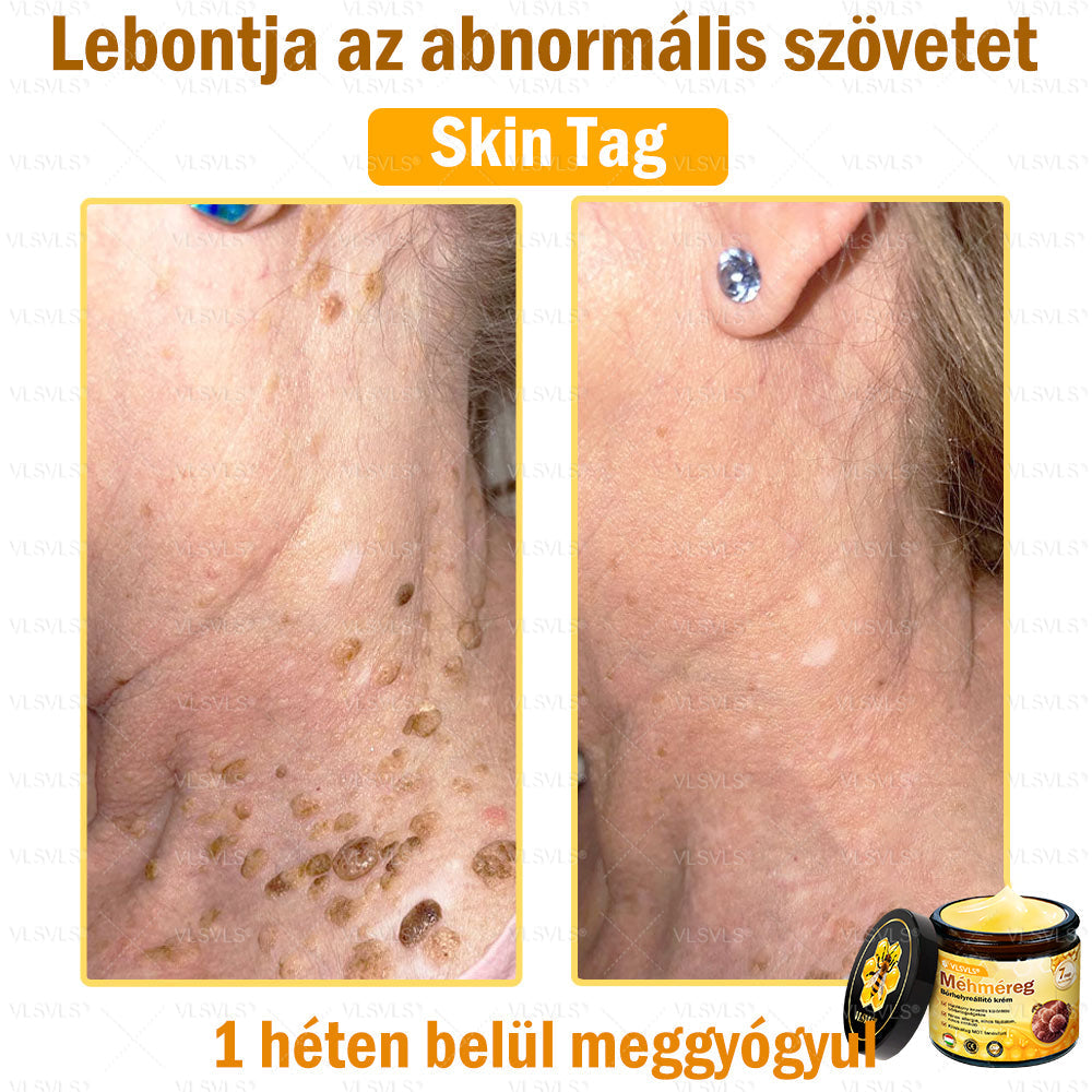 🎀🎀VLSVLS® 𝐌É𝐇𝐌É𝐑𝐄𝐆 Á𝐓𝐅𝐎𝐆Ó 𝐊𝐑É𝐌🥇𝐀 𝐛ö𝐫𝐩𝐫𝐨𝐛𝐥é𝐦á𝐤 𝐤𝐞𝐳𝐞𝐥é𝐬𝐞 𝐦𝐚𝐠á𝐛𝐚𝐧 𝐟𝐨𝐠𝐥𝐚𝐥𝐣𝐚: é𝐥𝐞𝐭𝐤𝐨𝐫𝐢 𝐟𝐨𝐥𝐭𝐨𝐤, 𝐡𝐞𝐠𝐞𝐤, 𝐬𝐳𝐞𝐦ö𝐥𝐜𝐬ö𝐤, 𝐛ö𝐫𝐧ö𝐯𝐞𝐝é𝐤𝐞𝐤, 𝐭á𝐥𝐲𝐨𝐠𝐨𝐤, 𝐩𝐚𝐭𝐭𝐚𝐧á𝐬𝐨𝐤, 𝐞𝐤𝐜é𝐦𝐚, 𝐩𝐬𝐨𝐫𝐢𝐚𝐬𝐢𝐬, 𝐚𝐜𝐧𝐞 𝐢𝐧𝐯𝐞𝐫𝐬𝐚, 𝐫á𝐧𝐜𝐨𝐤, 𝐛ö𝐫ö𝐫𝐞𝐠𝐞𝐝é𝐬 é𝐬 𝐞𝐠𝐲é𝐛 𝐩𝐫𝐨𝐛𝐥é𝐦á𝐤🔥
