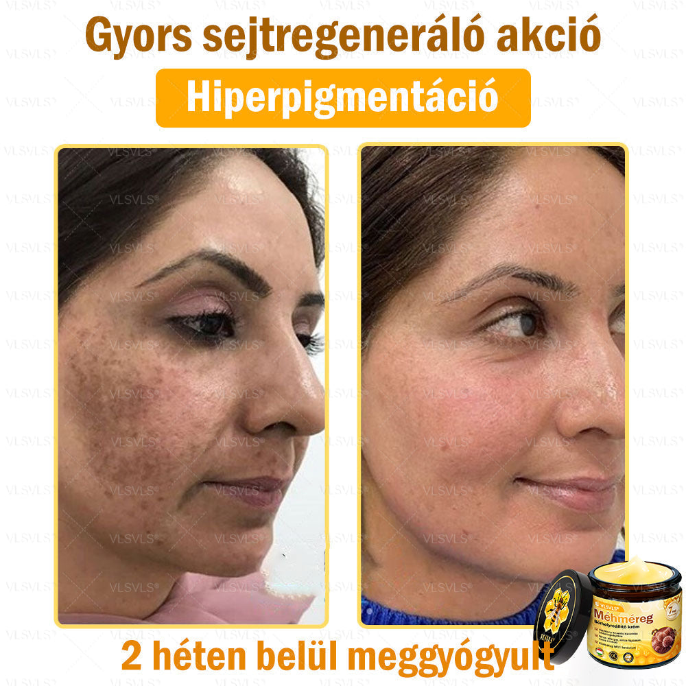 🎀🎀VLSVLS® 𝐌É𝐇𝐌É𝐑𝐄𝐆 Á𝐓𝐅𝐎𝐆Ó 𝐊𝐑É𝐌🥇𝐀 𝐛ö𝐫𝐩𝐫𝐨𝐛𝐥é𝐦á𝐤 𝐤𝐞𝐳𝐞𝐥é𝐬𝐞 𝐦𝐚𝐠á𝐛𝐚𝐧 𝐟𝐨𝐠𝐥𝐚𝐥𝐣𝐚: é𝐥𝐞𝐭𝐤𝐨𝐫𝐢 𝐟𝐨𝐥𝐭𝐨𝐤, 𝐡𝐞𝐠𝐞𝐤, 𝐬𝐳𝐞𝐦ö𝐥𝐜𝐬ö𝐤, 𝐛ö𝐫𝐧ö𝐯𝐞𝐝é𝐤𝐞𝐤, 𝐭á𝐥𝐲𝐨𝐠𝐨𝐤, 𝐩𝐚𝐭𝐭𝐚𝐧á𝐬𝐨𝐤, 𝐞𝐤𝐜é𝐦𝐚, 𝐩𝐬𝐨𝐫𝐢𝐚𝐬𝐢𝐬, 𝐚𝐜𝐧𝐞 𝐢𝐧𝐯𝐞𝐫𝐬𝐚, 𝐫á𝐧𝐜𝐨𝐤, 𝐛ö𝐫ö𝐫𝐞𝐠𝐞𝐝é𝐬 é𝐬 𝐞𝐠𝐲é𝐛 𝐩𝐫𝐨𝐛𝐥é𝐦á𝐤🔥